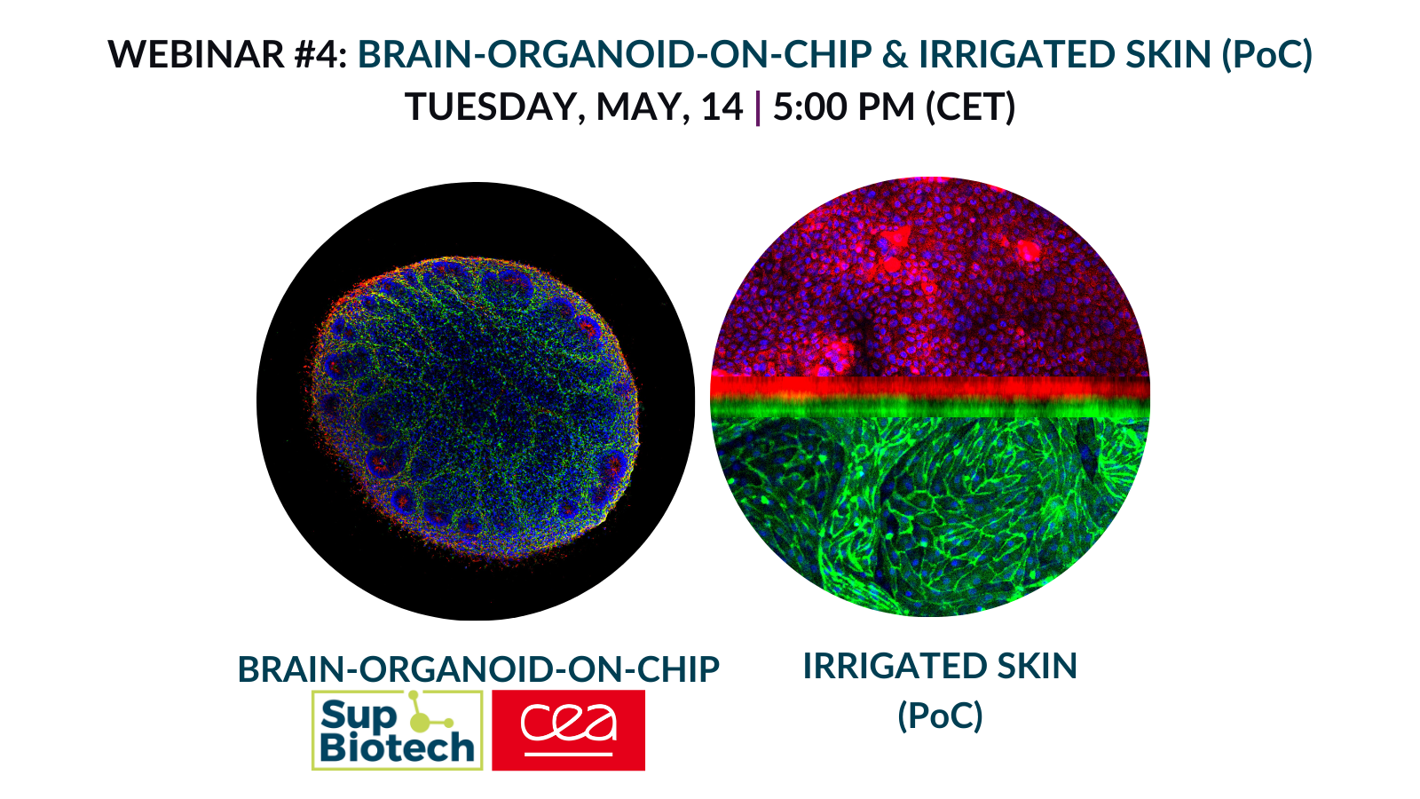 [2024] Webinar #4 - Brain Organoid-on-chip & Irrigated Skin